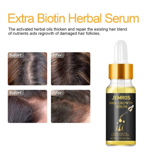 Hair Growth Essential Oils Hair Growth Liquid Hair Care Essential Oils - Image 4